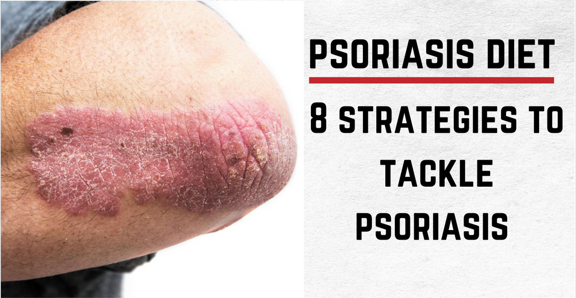 Psoriasis Diet: 8 Ways to Take on Psoriasis from the Inside